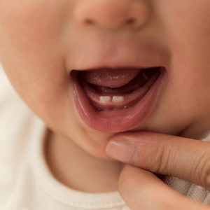 como aliviar a dor do dente nascendo no bebe